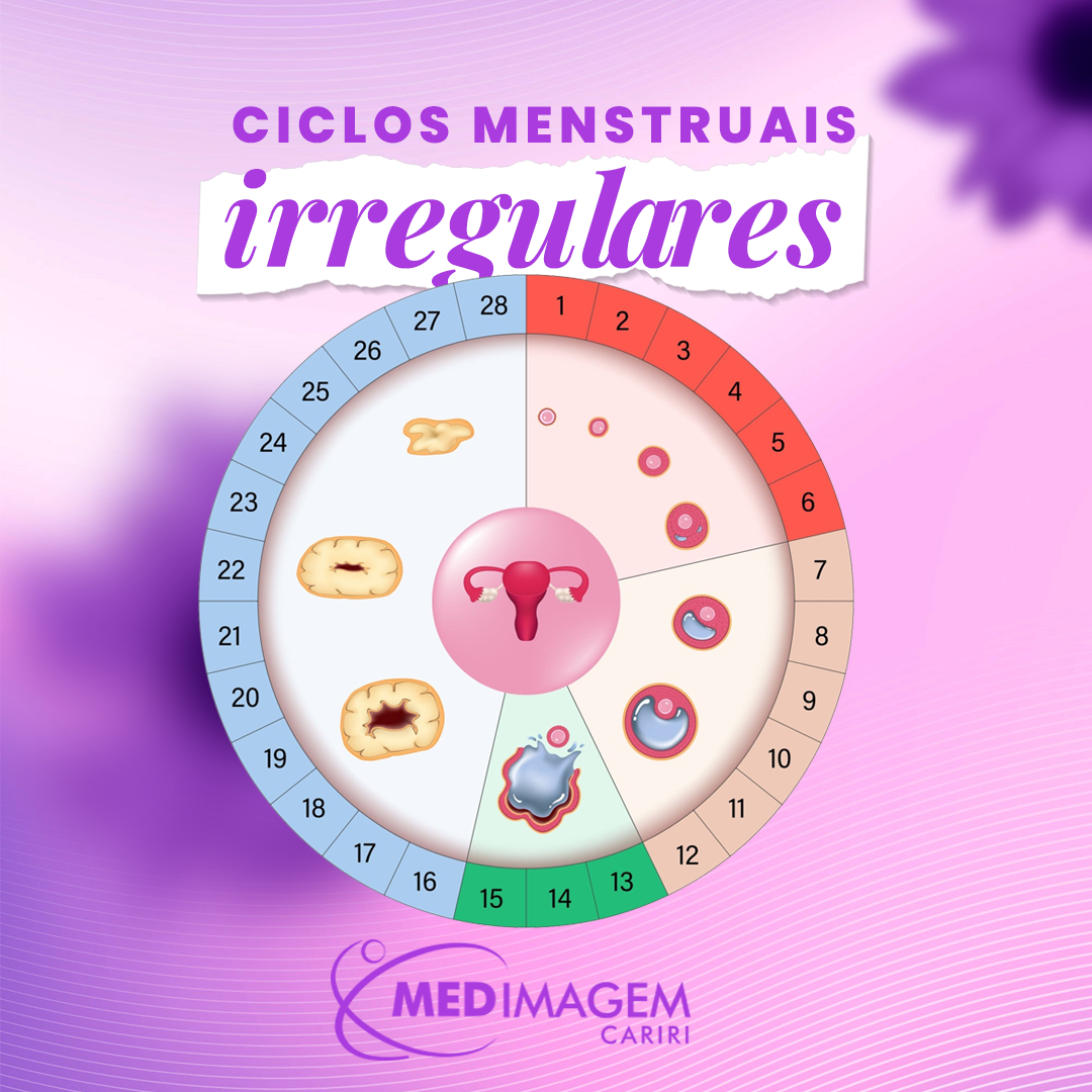 Menstruação irregular: o que é, quais são as causas e como tratar